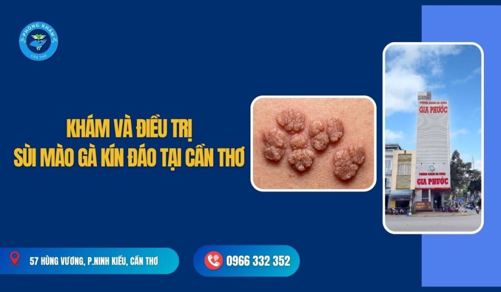 Địa chỉ khám sùi mào gà cho nữ kín đáo, bảo mật tại Cần Thơ - Phòng Khám Cần Thơ