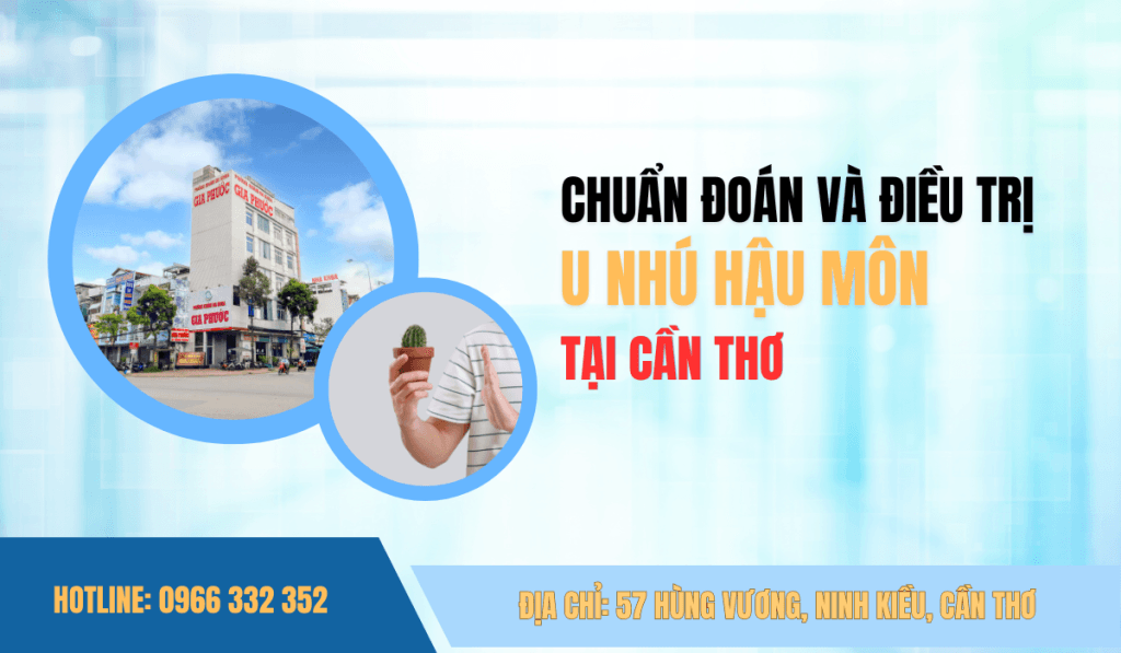 Địa chỉ chẩn đoán và điều trị nhú hậu môn uy tín tại Cần Thơ
