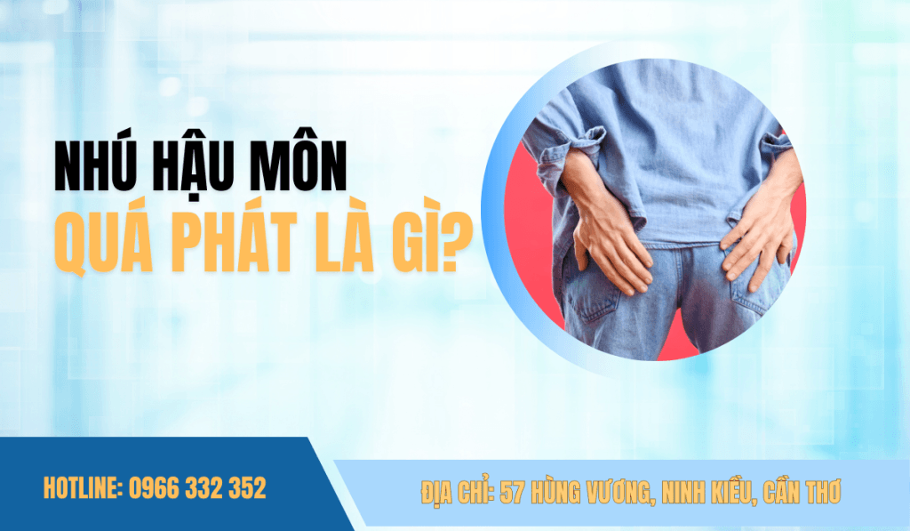Nhú Hậu Môn Quá Phát Là Gì Phân Biệt Với Sùi Mào Gà & Cách Chữa Trị Tại Cần Thơ