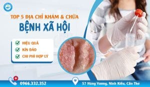 Top 5 địa chỉ khám chữa bệnh xã hội ở cà mau uy tín kín đáo
