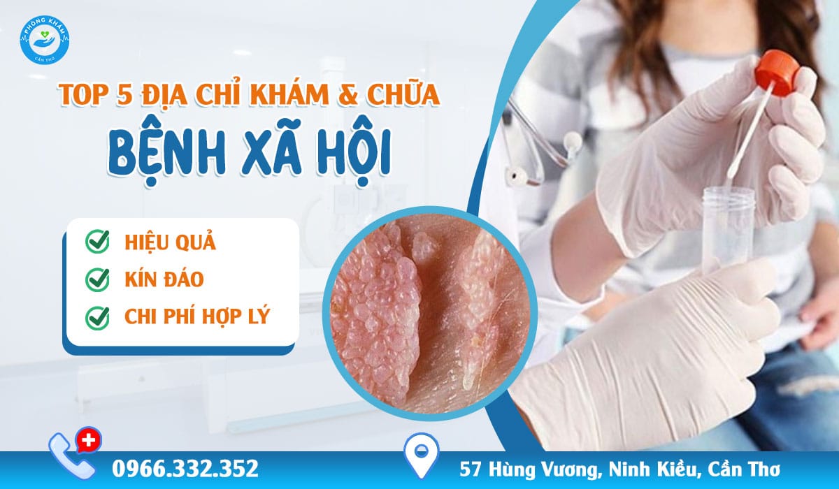 Top 5 địa chỉ khám chữa bệnh xã hội ở cà mau uy tín kín đáo