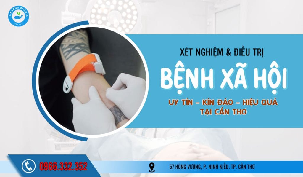 Top 5 địa chỉ khám chữa bệnh xã hội ở Trà Vinh uy tín, riêng tư, chi phí hợp lý