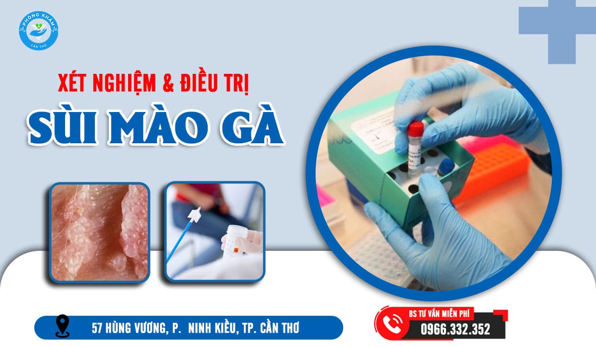 Top 5 địa chỉ xét nghiệm sùi mào gà ở an giang uy tín