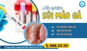 Top 5 địa chỉ xét nghiệm sùi mào gà ở Cần Thơ