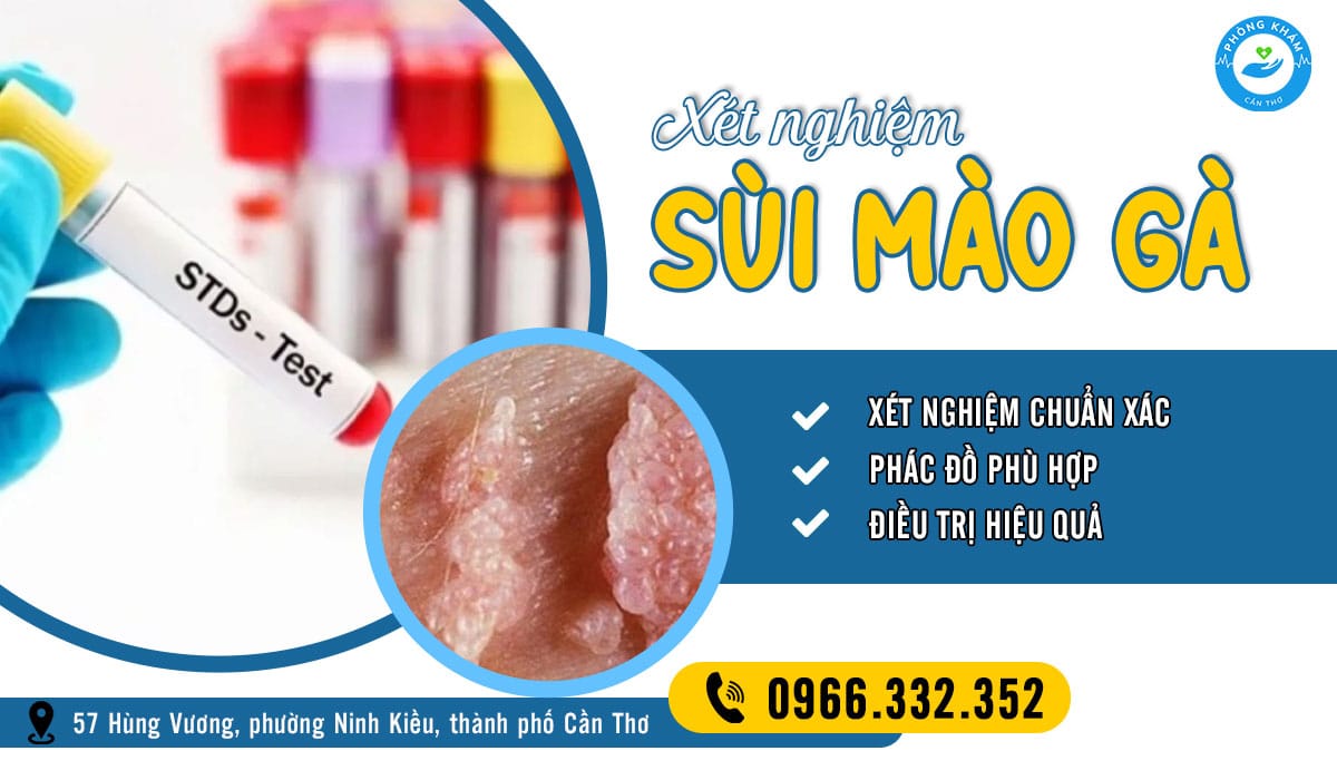 Top 5 địa chỉ xét nghiệm sùi mào gà ở Cần Thơ