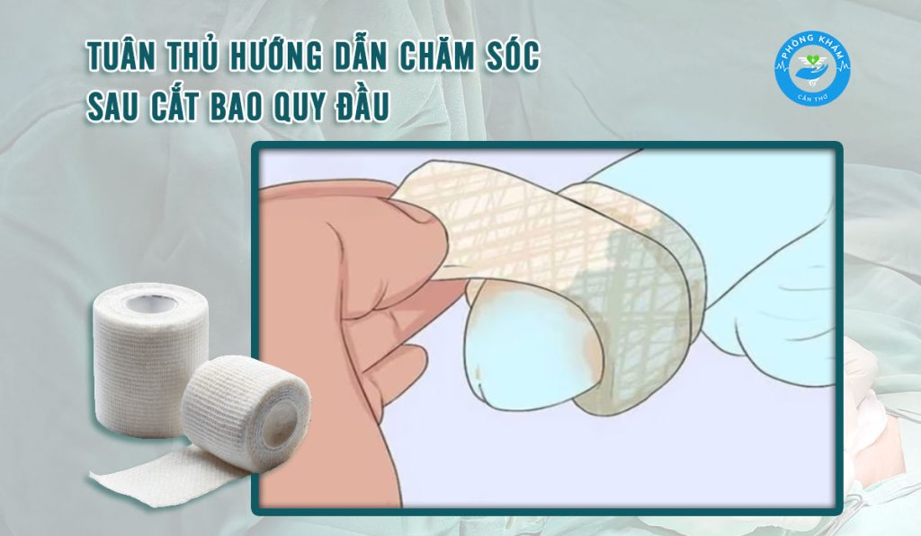 Chăm sóc sau cắt bao quy đầu như thế nào?