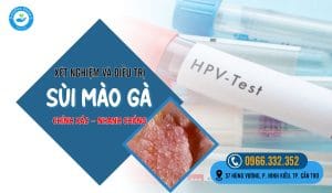 Top 5 địa chỉ xét nghiệm sùi mào gà ở cà mau đáng tin cậy