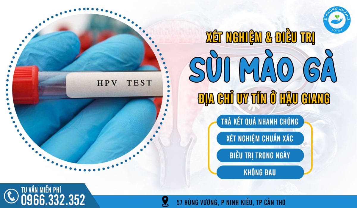 Top 5 địa chỉ xét nghiệm sùi mào gà ở Hậu Giang đáng tin cậy