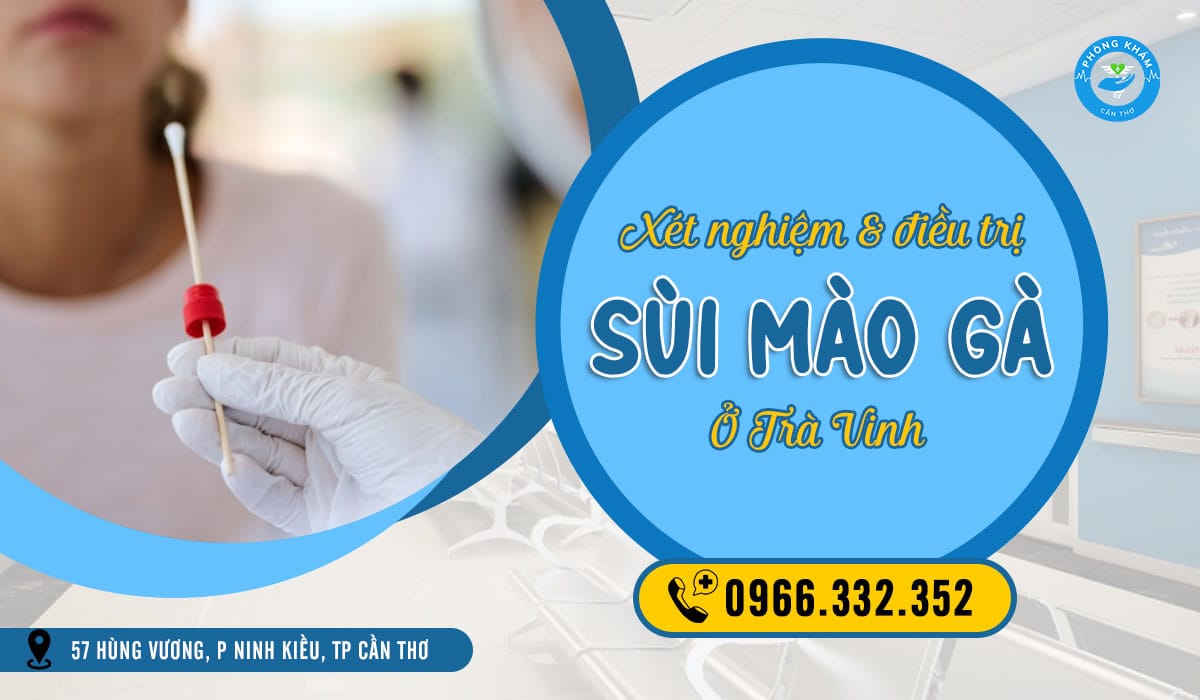 Top 5 địa chỉ xét nghiệm sùi mào gà ở Trà Vinh