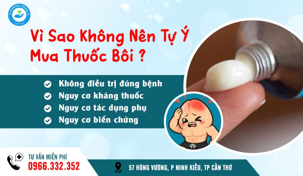 Nam giới tuyệt đối không nên tự ý mua thuốc bôi trị viêm bao quy đầu tại nhà