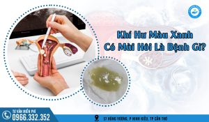 Khí hư màu xanh có mùi hôi là bệnh gì?