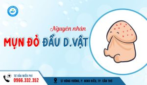 Nổi mụn đỏ ở đầu dương vật là bệnh gì?