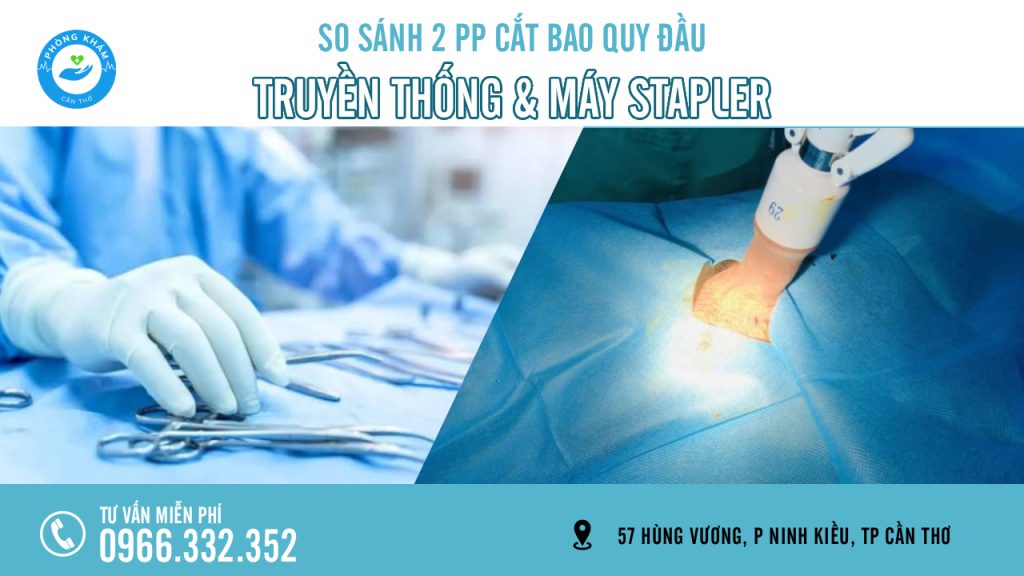 Cắt bao quy đầu truyền thống hay máy Stapler tốt hơn?