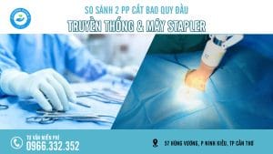Cắt bao quy đầu truyền thống hay máy Stapler tốt hơn?