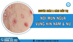 Nổi mụn ngứa vùng kín: Nguyên nhân và cách điều trị hiệu quả