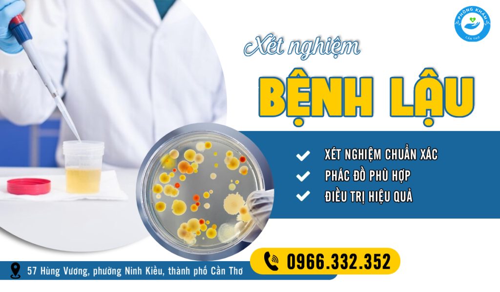 Quan hệ không an toàn bao lâu thì xét nghiệm lậu cho ra kết quả chuẩn