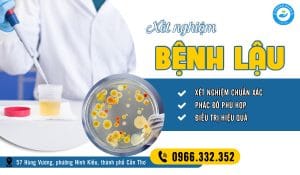 Quan hệ không an toàn bao lâu thì xét nghiệm lậu cho ra kết quả chuẩn